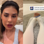 Simone Mendes explica motivo de nova cirurgia estética: “Me deixava com autoestima baixa”